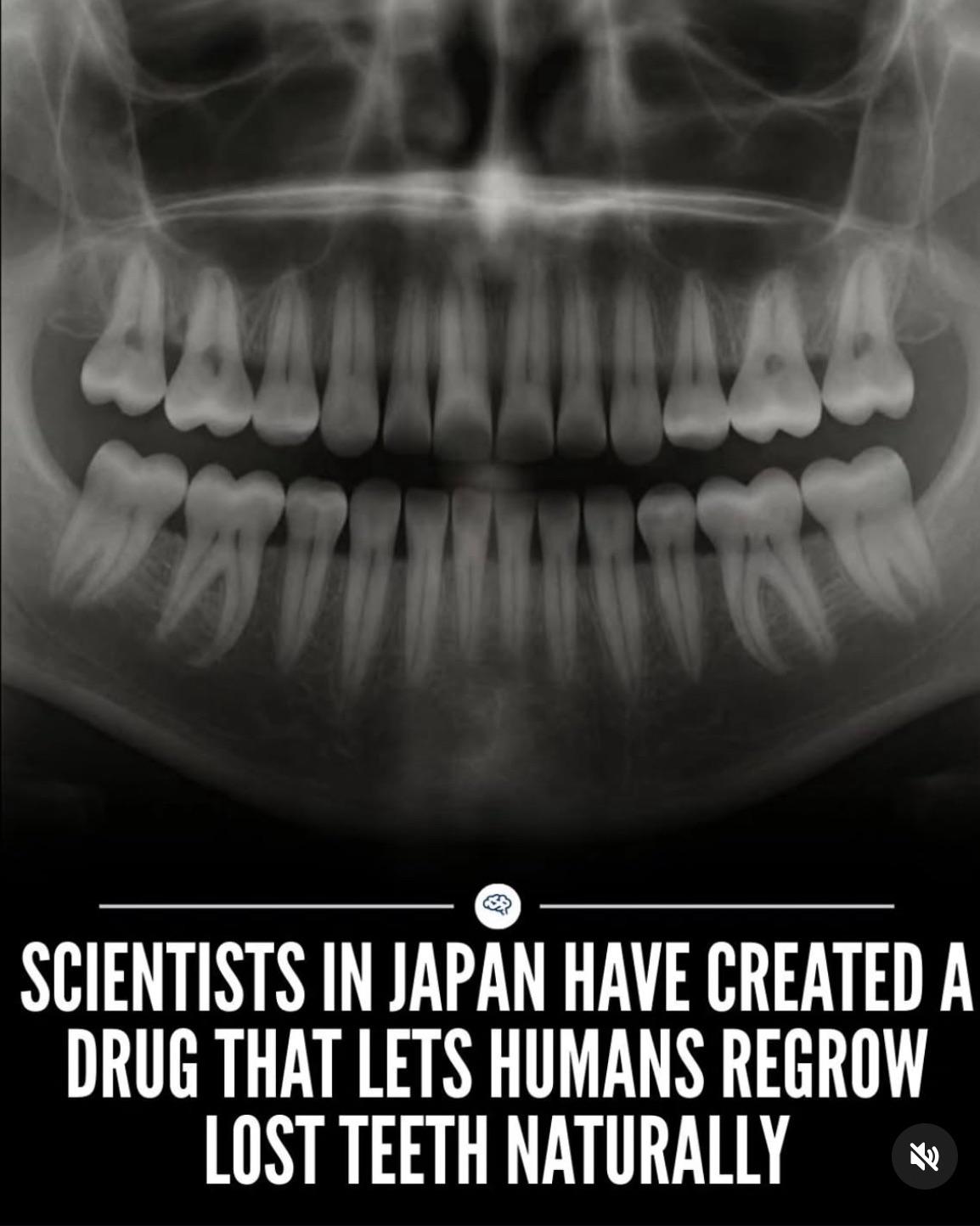 日本の歯再生薬が話題に「富裕層専用になるのかが心配」